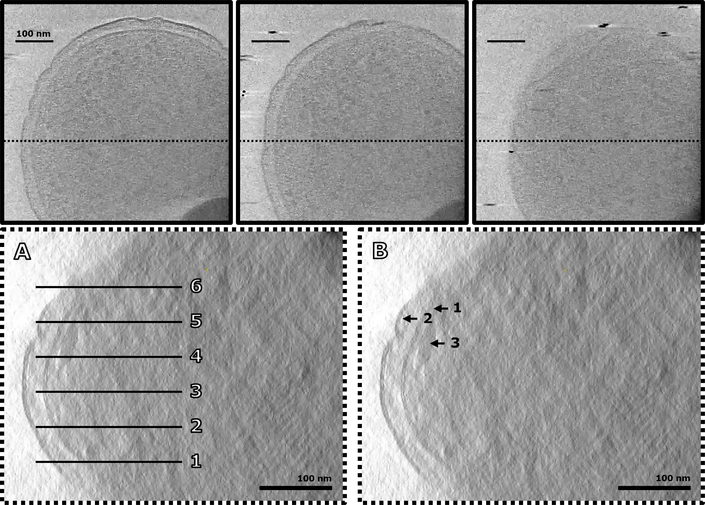 cryoet